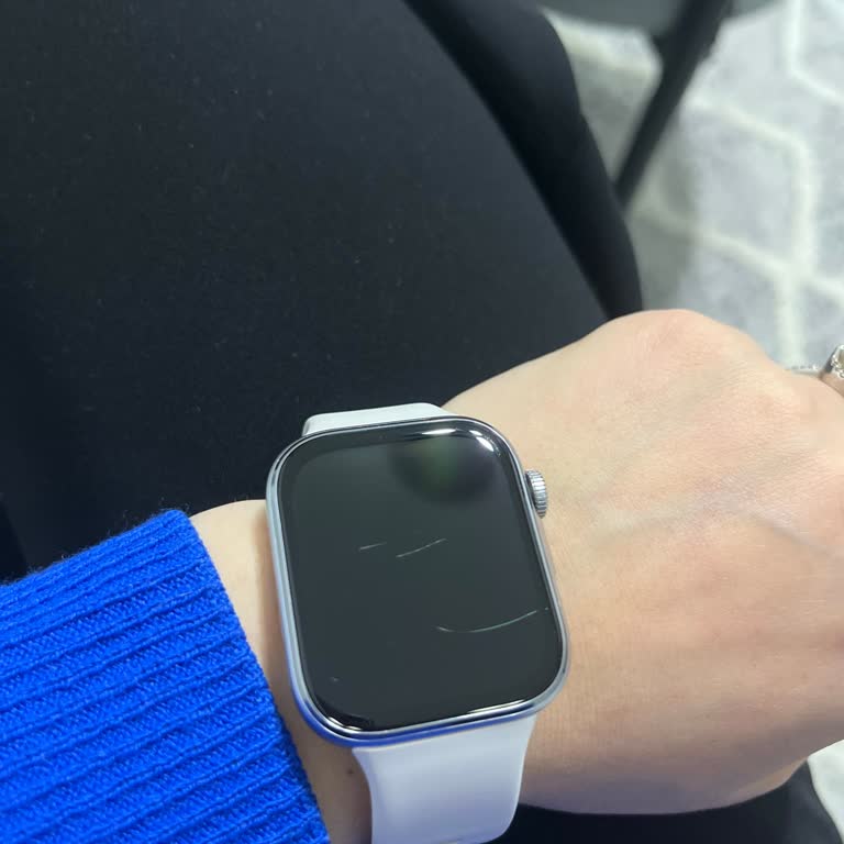 Yeni Alınan Huawei Watch Fit 4 Saatin Ekranında Kısa Sürede Çizik Oluşması Ve Yedek Parça Sorunu