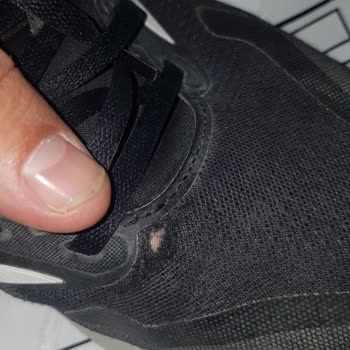 Adidas Ayakkabıda Kısa Sürede Yaşanan Soruna Garanti Reddi Ve Mağduriyet