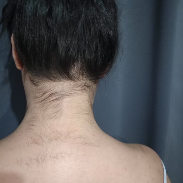 Asia Güzellik Ödediğim Paralara Rağmen Hizmetten Sonuç Alamadım!