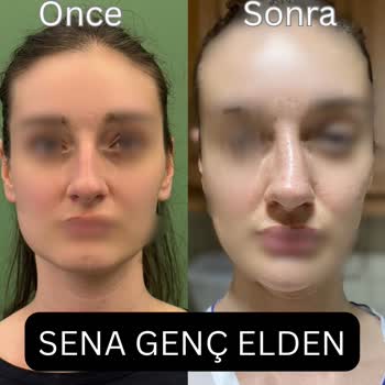 Ameliyat Sonrası Mağduriyet Ve Sorumluluk Reddiyle Travmatik Bir Deneyim