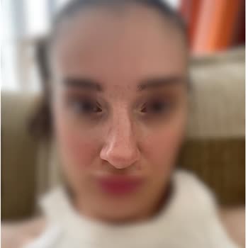 Ameliyat Sonrası Mağduriyet Ve Sorumluluk Reddiyle Travmatik Bir Deneyim