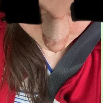 Ameliyat Sonrası Mağduriyet Ve Sorumluluk Reddiyle Travmatik Bir Deneyim