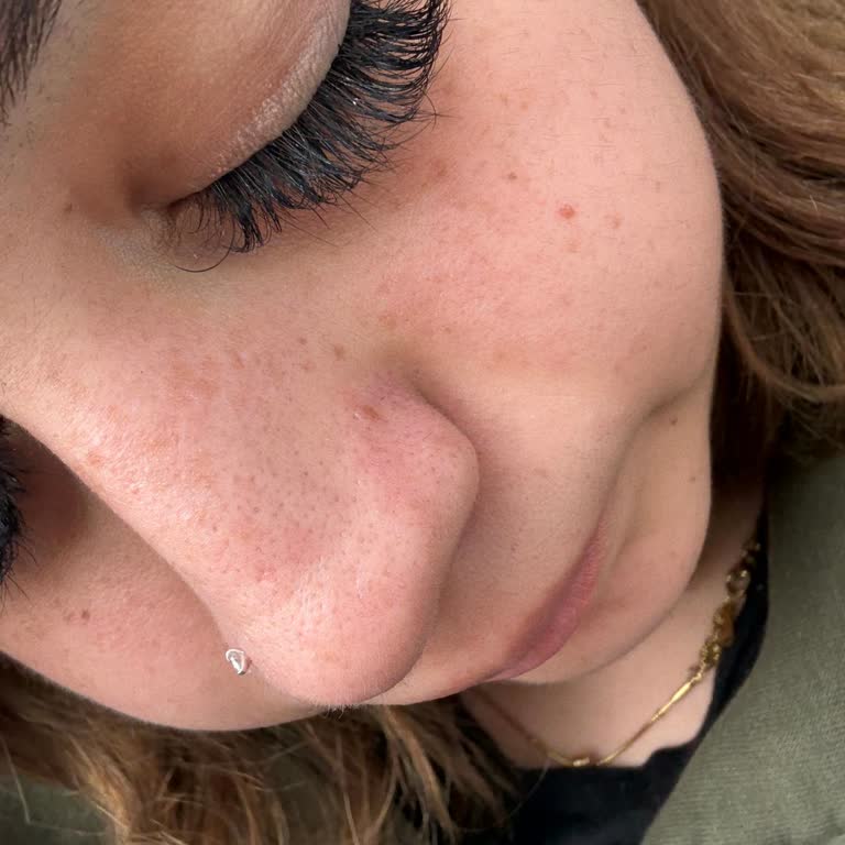 Hijyen Eksikliği ve Uygulama Sonrası Sağlık Sorunu Hakkında Şikayet