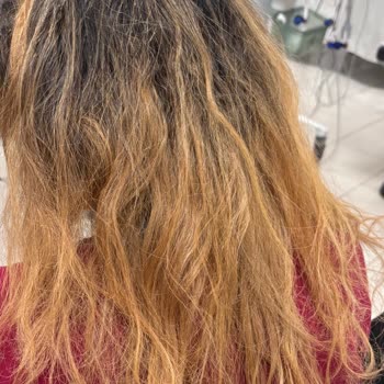 Saçlarım Yandı, Mağduriyetim Giderilmedi!