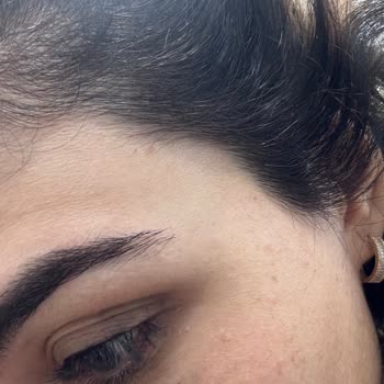 Saçlarım Yandı, Mağduriyetim Giderilmedi!