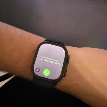 Turkcell Hattında Apple Watch Ultra 3 İle Hücresel Arama Sorunu Ve Fatura Mağduriyeti