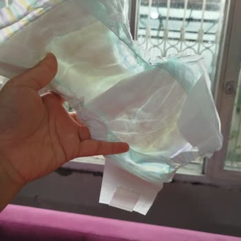 Jenny Willy Bebek Bezleri Sızdırıyor Mağaza Çözüm Sunmuyor