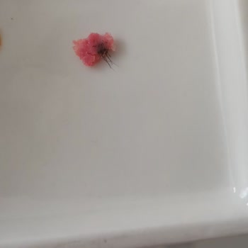 Salamın İçinden Çıkan Kıllı Hayvan Derisiyle Şok Oldum