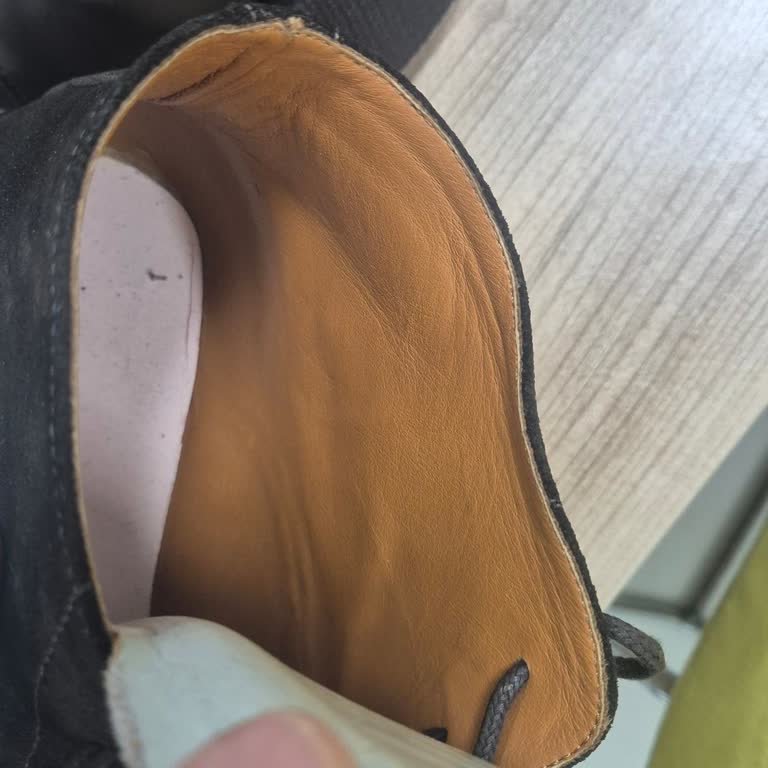 Ayakkabının İçinden Çıkan Çivi Sağlığımızı Tehlikeye Attı Çözüm Sunulmadı