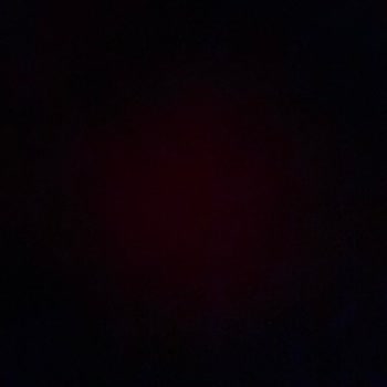 Eksik Parça Ve Yetersiz Satış Sonrası Hizmet