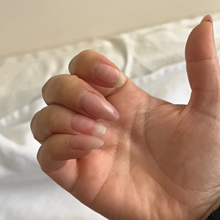 Protez Tırnak İşlemi Başarısız Oldu, Ücret İadesi Talep Ediyorum