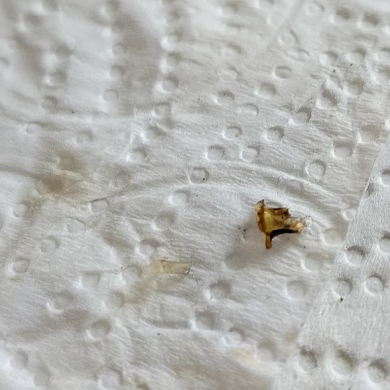 Puding İçinden Plastik Parça Ve Bant Çıktı, Para İadesi Talebim Var