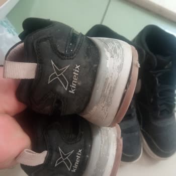 Garantili Ayakkabılarda Üretim Hatası Ve İlgisiz Mağaza Mağduriyeti