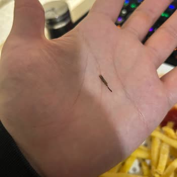 Siparişimde Yabancı Madde Çıktı, Müşteri Hizmetleri Çözüm Sunmadı