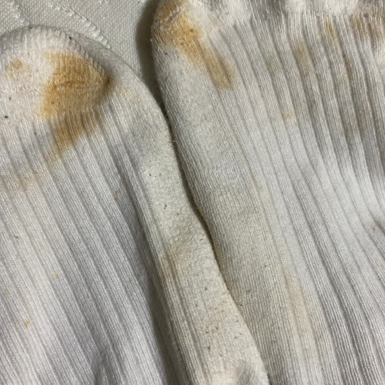 Süet Ayakkabının Rengi Çorabıma Geçiyor, Ücret İadesi İstiyorum