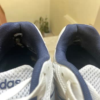 Adidas Ayakkabının İç Astarı 6 Ayda Söküldü Değişim Talebim Reddedildi