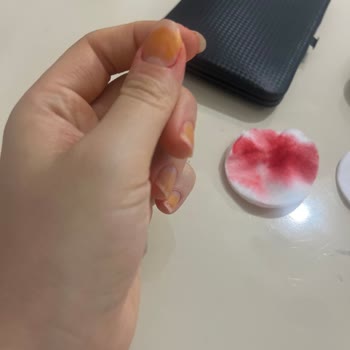 Oje Tırnaklarımda Sarı Leke Bıraktı Nedenini Öğrenmek İstiyorum