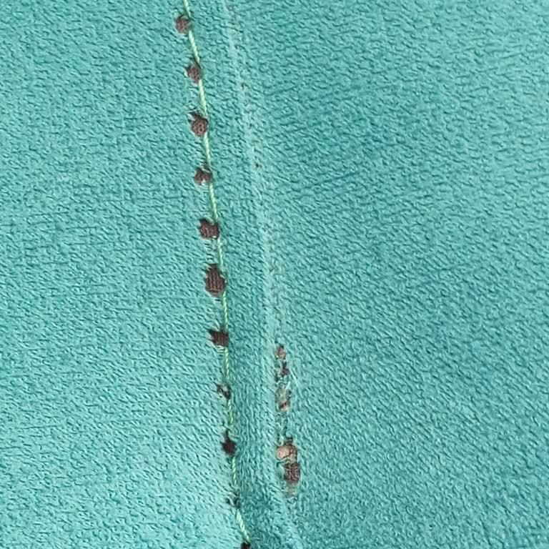 Koltuk Takımında Dikiş Açılması Ve Garanti Kapsamında Destek Eksikliği