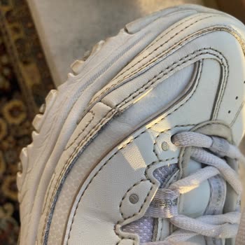 Skechers Ayakkabım Kısa Sürede Yırtıldı Müşteri Hizmetleri Çözüm Sunmadı