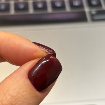 Jel Güçlendirme Sonrası Tırnaklarım Mahvoldu Ve Sosyal Medya Ekibi İlgisizdi