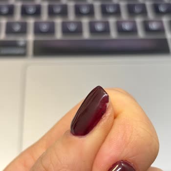 Jel Güçlendirme Sonrası Tırnaklarım Mahvoldu Ve Sosyal Medya Ekibi İlgisizdi