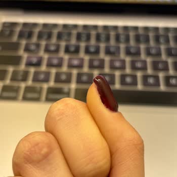 Jel Güçlendirme Sonrası Tırnaklarım Mahvoldu Ve Sosyal Medya Ekibi İlgisizdi