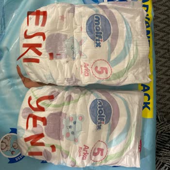 Molfix Bebek Bezi Boyut Sorunu Ve Müşteri Hizmetlerine Ulaşılamıyor