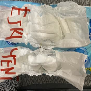 Molfix Bebek Bezi Boyut Sorunu Ve Müşteri Hizmetlerine Ulaşılamıyor