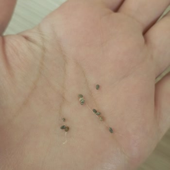 Aldığım Chia Tohumunda Böcek Ve Ağ Çıktı Para İadesi İstiyorum