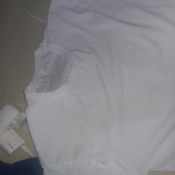 Ayıplı Takım Elbise Ve İade Sürecinde İletişim Sorunu Yaşadım