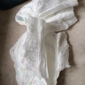 Molfix Külot Bez Paketi İçinde Kullanılamaz Bezlerle Karşılaştım