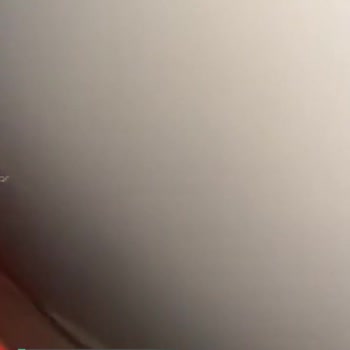 Dyson V15 Aniden Bozulmuş