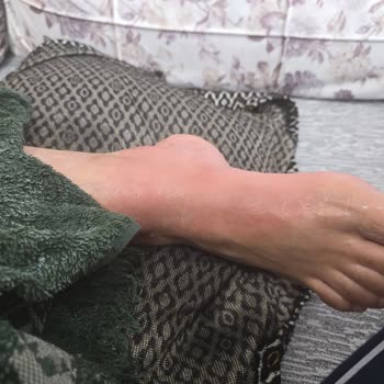 Fakir Çay Makinesi Kulpunun Kopmasıyla Yanık Ve Güvenlik Riski Yaşadım