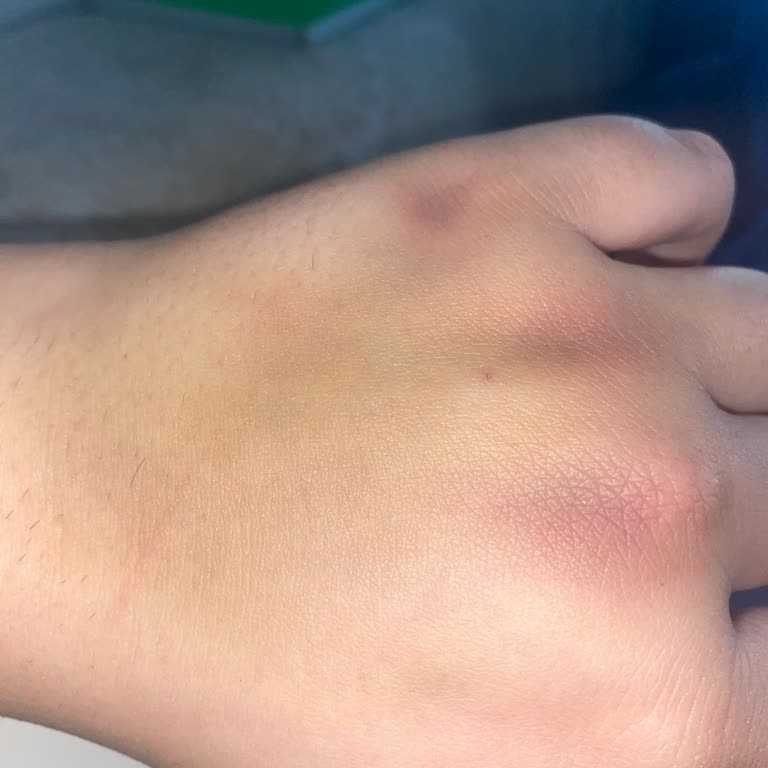 Alaeddin Yavaşça Devlet Hastanesi Acil Serviste Damar Yolu Açılırken Yaşadığım Mağduriyet Ve Endişe!