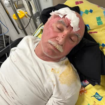 Ambulans Ekibinin İhmali Sonucu Babamın Yaralanması Ve Sedyeden Düşmesi