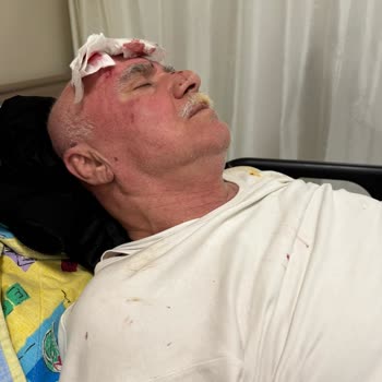 Ambulans Ekibinin İhmali Sonucu Babamın Yaralanması Ve Sedyeden Düşmesi