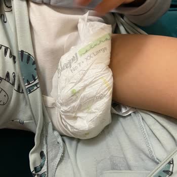 Sleepy Bebek Bezlerinde Cırt Cırt Yapışmama Sorunu Mağduriyet Yaşadım