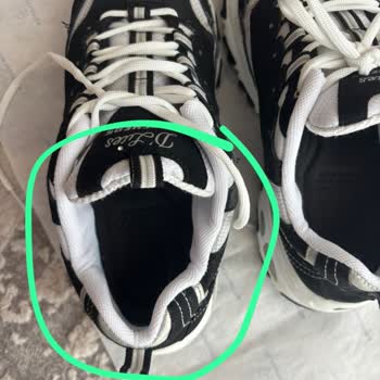 Ayakkabım Garanti Kapsamında Tamir Edildi, Kullanılamaz Hale Geldi Ve Para İadesi Reddedildi