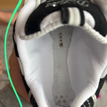 Ayakkabım Garanti Kapsamında Tamir Edildi, Kullanılamaz Hale Geldi Ve Para İadesi Reddedildi