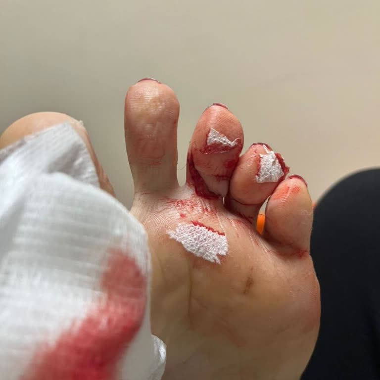 Acil Serviste Uzun Süre Bekletilme Ve Yetersiz Bilgilendirme Mağduriyeti