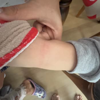 Çocuğumun Ayağını Yaralayan Ayakkabıya Skechers'dan Yetersiz Destek