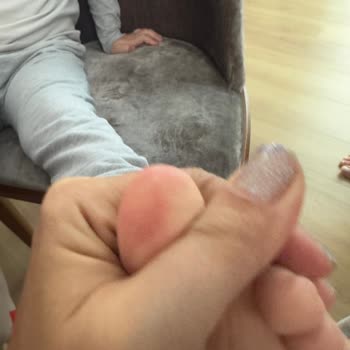 Çocuğumun Ayağını Yaralayan Ayakkabıya Skechers'dan Yetersiz Destek