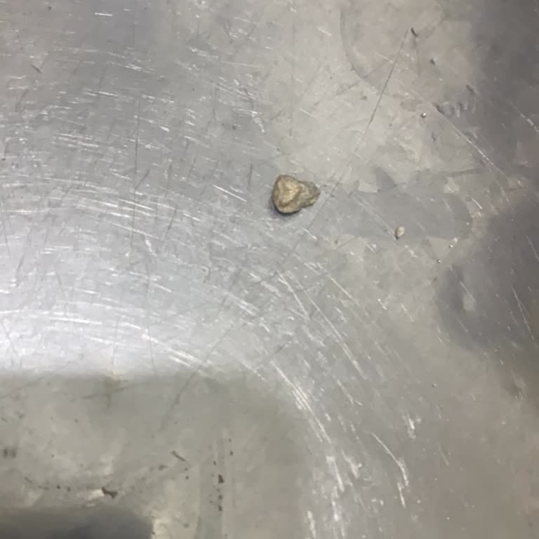 Dönerin İçinden Taş Çıktı, Hijyen Ve Güvenlik Riski Yaşadım