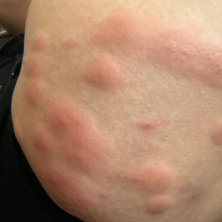 Akgünler Denizcilik Feribotta Böcek Sorunu Ve Cevapsız Şikayetler: Sağlığım Tehlikede!