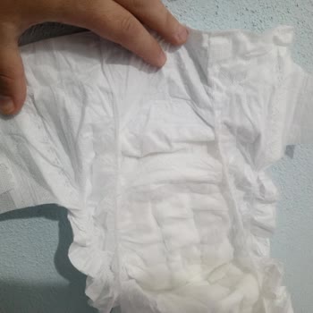 Aldığım Bebek Bezleri Kullanılamaz Durumda Çıktı!