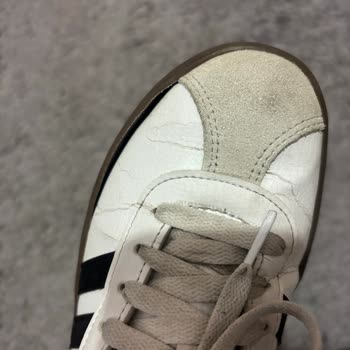 Adidas Ayakkabı Kısa Sürede Açıldı İade Talebim Reddedildi