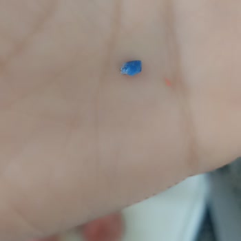 Namet Dana Sucukta Plastik Parça Çıktı, Sağlığım Tehlikeye Girdi