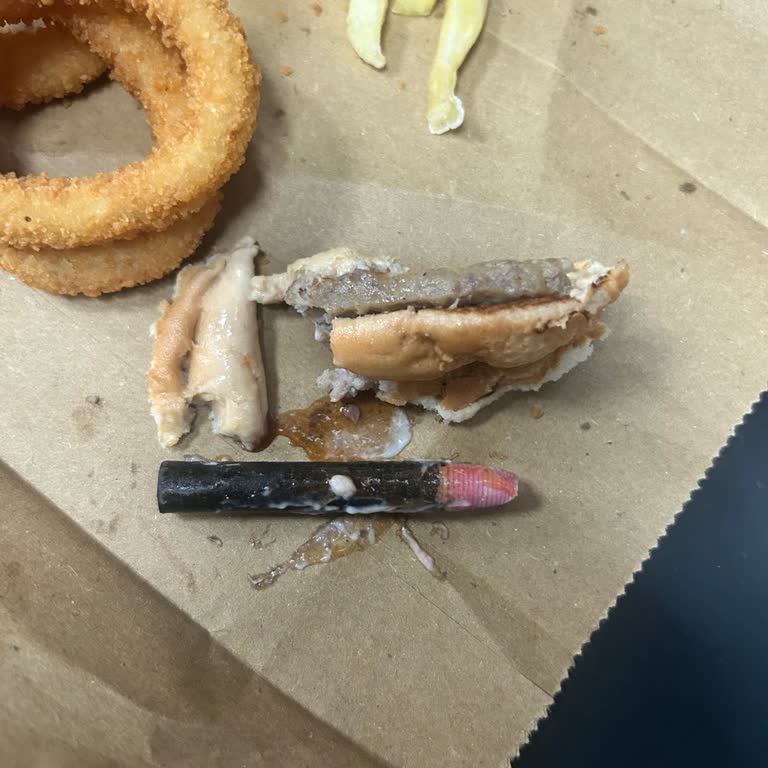 Hamburgerin İçinden Çıkan Yabancı Cisim Nedeniyle Dişim Kırıldı Hijyen Ve İlgi Eksikliği