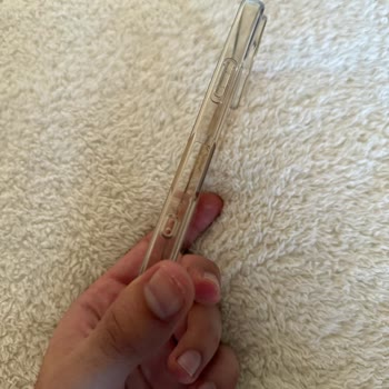 Sararma Karşıtı Kılıfın Kısa Sürede Sararması Ve Hayal Kırıklığı