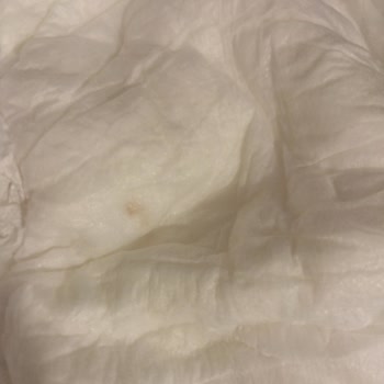 Sleepy 6 Numara Bebek Bezlerinde Leke Problemi Ve Müşteri Hizmetlerine Ulaşamama